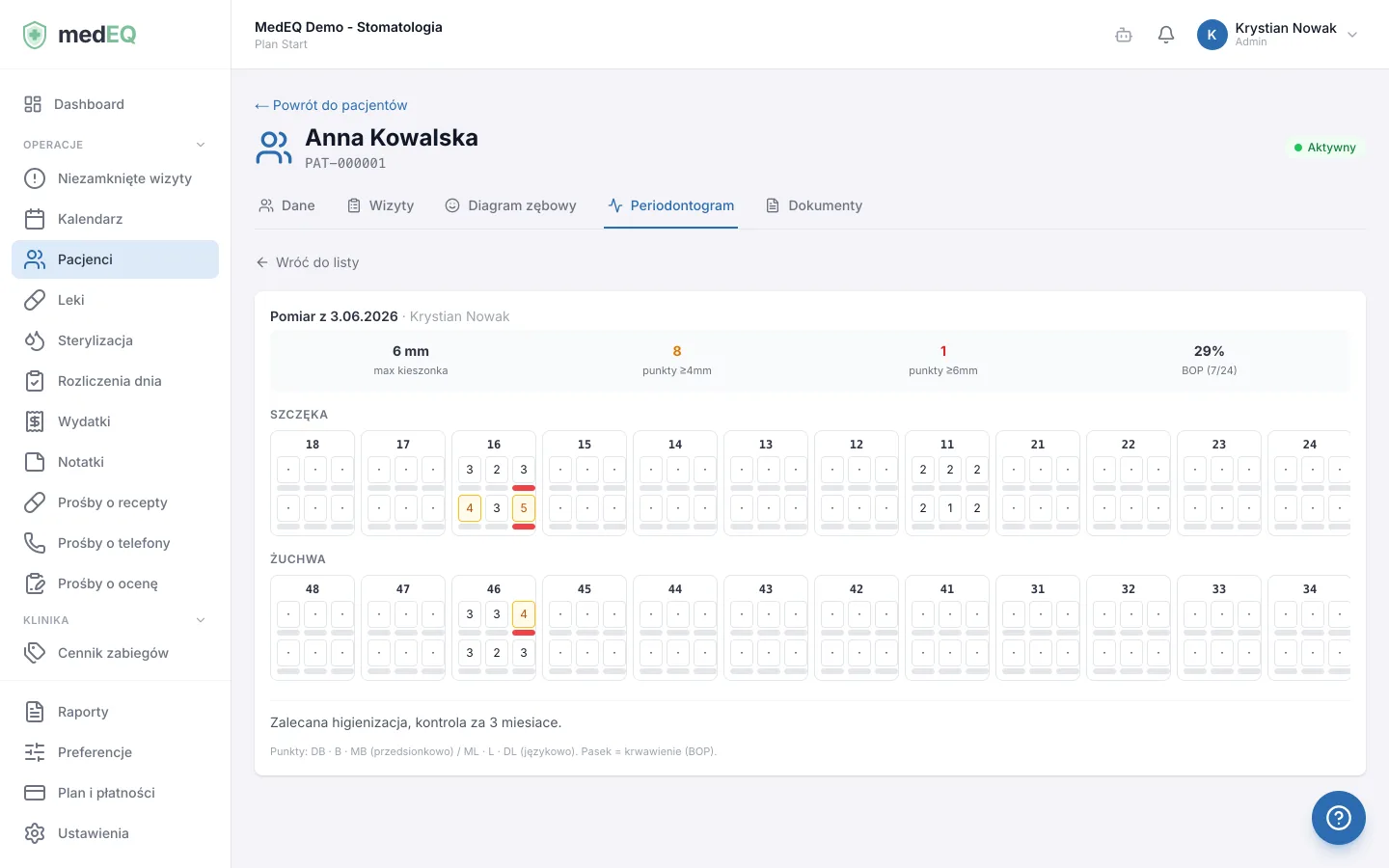 Periodontogram - głębokości kieszonek w 6 punktach, krwawienie (BOP) i podsumowanie stanu przyzębia.